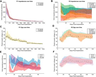 Explant Analysis of Utah Electrode Arrays Implanted in Human Cortex for Brain-Computer-Interfaces